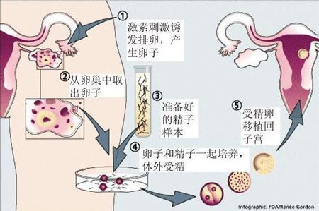 李晴阳院长